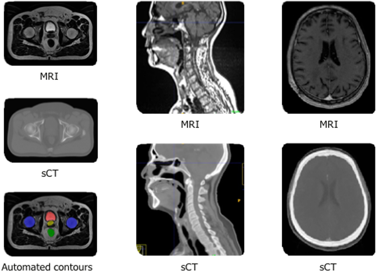 Enabling Radiation Oncology Treatment Planning with Advanced Imaging